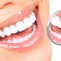 Best Teeth Whitening Solution